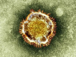 Sars virüsü tekrar hortladı: 4 ölü