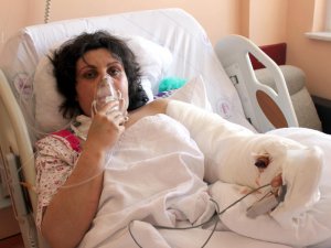 Kadın işçinin kopan kolu yerine dikildi