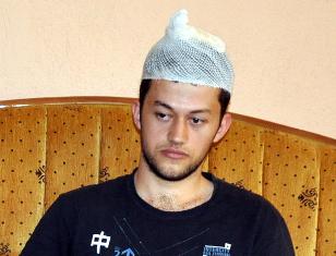 Hayalleri için 20 dikişi saçının üzerinden attırdı