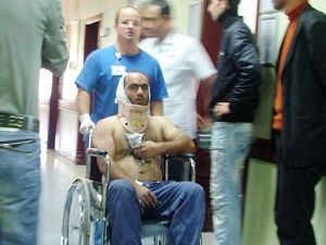 Yem kırma makinasi kulağını kopardı
