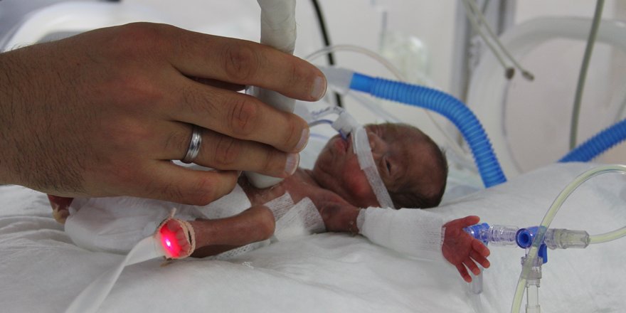 514 gram doğan bebeğe "hayat" operasyonu
