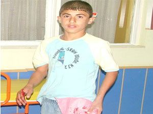 Köpeğin saldırdığı çocuk hastanelik oldu