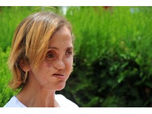 İki Haftadır Nakil Bekleyen Selvinaz: Bana Mı Yapılacak Diye Düşündüm
